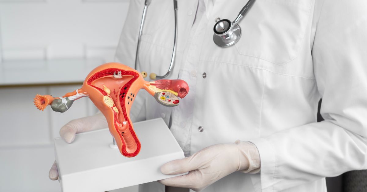 IUI Treatment Process, Cost, and Success Rate