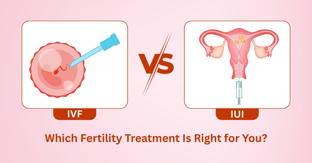 IVF vs IUI Which Fertility Treatment Is Right for You