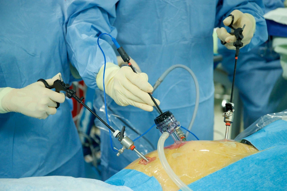 Laparoscopy Doctor in Ahmedabad